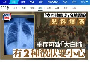 20231018肺炎